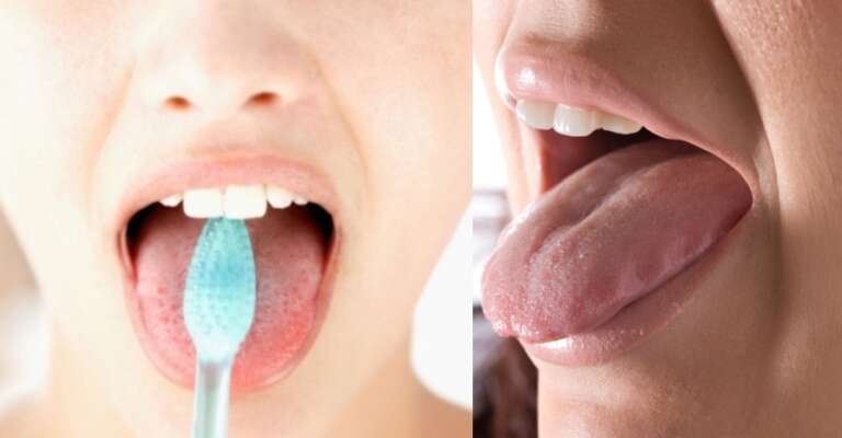 bad breath while fasting