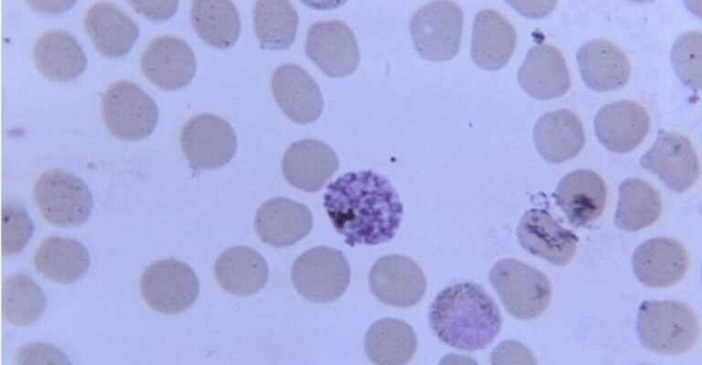 monkeypox