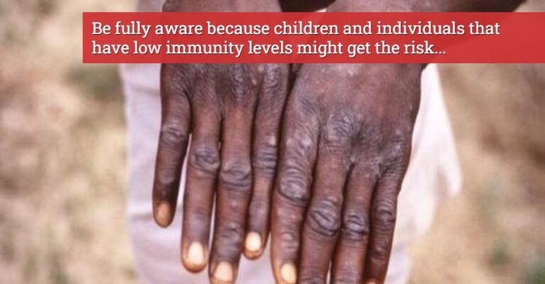 symptoms of monkeypox