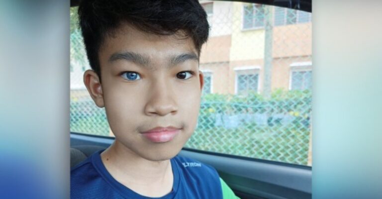 eyes
