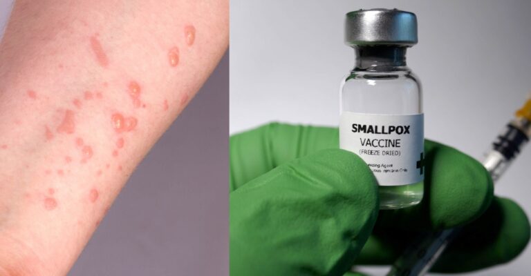 smallpox vaccine