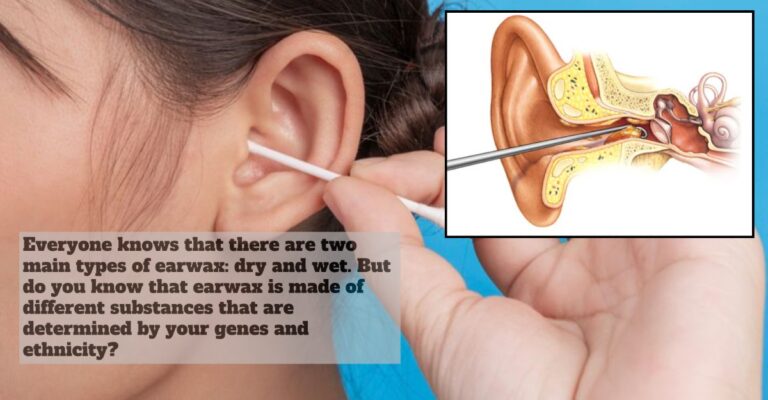 dry wet earwax