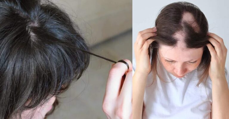 hair
