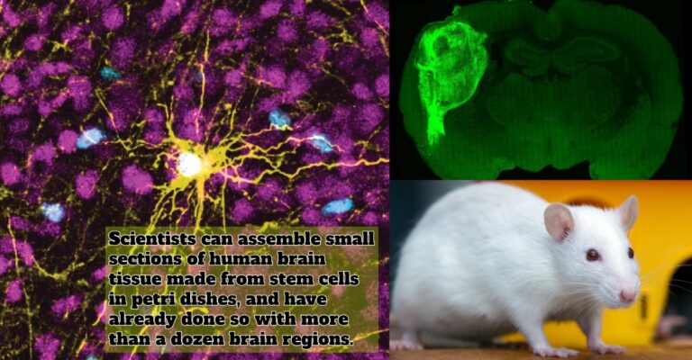 human brain cells