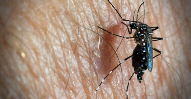 dengue fever