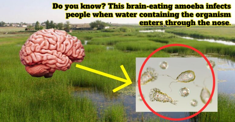 brain-eating amoeba