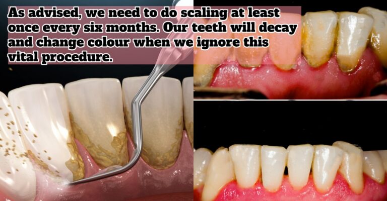 scaling