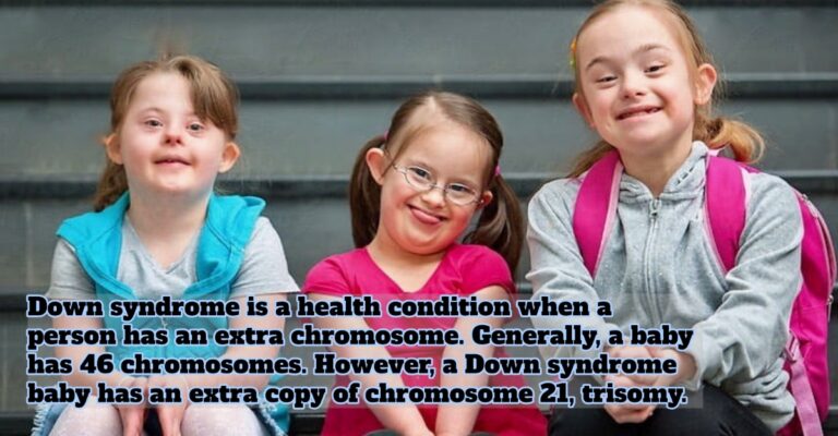 Down syndrome