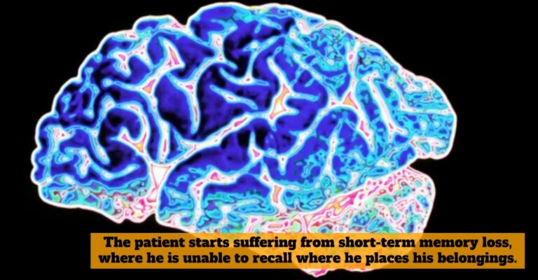 Alzheimer's