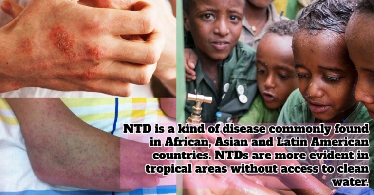 NTDs