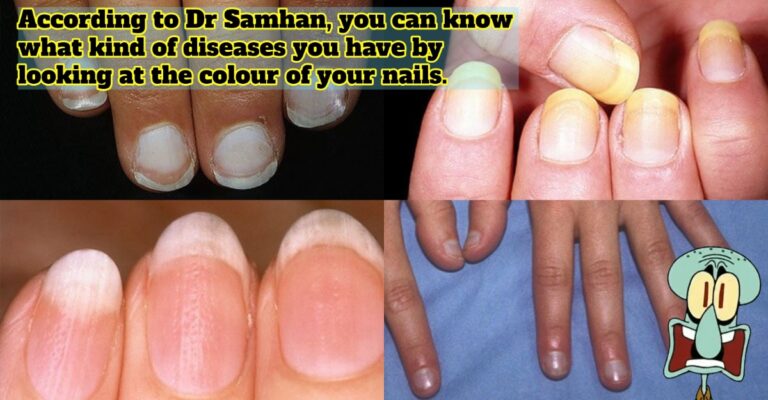 nail