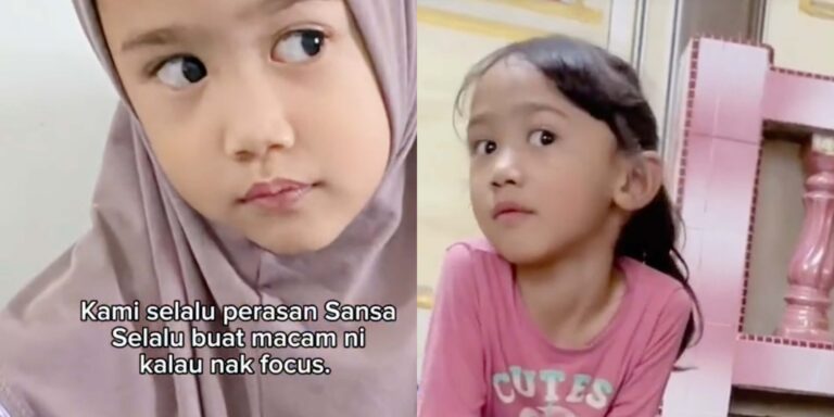 kids’ eye